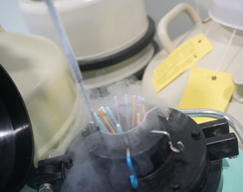 Embryo Freezing & Storage